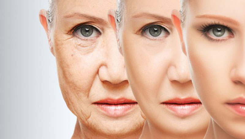 ageing