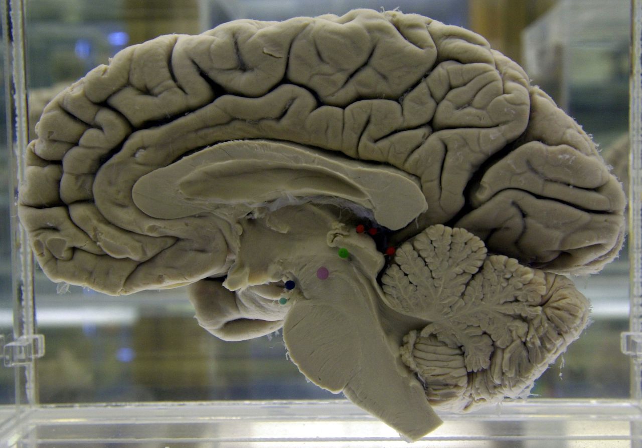 brain